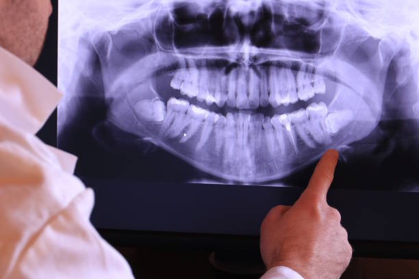 Best Emergency Cosmetic Dentistry in St Charles, MI