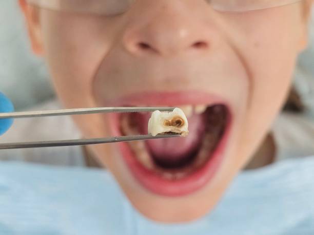 Best Mobile Emergency Dentist in St Charles, MI