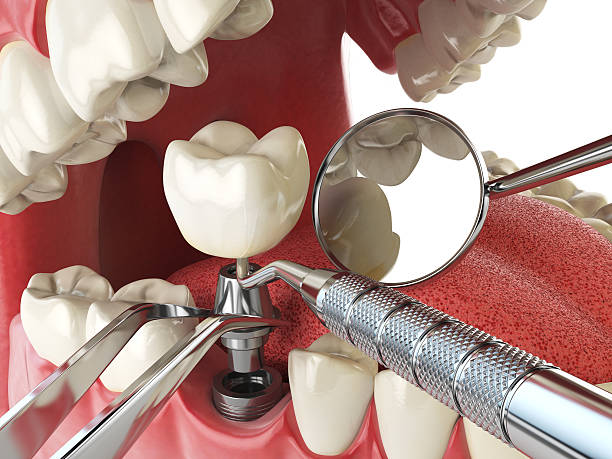 Best Weekend Emergency Dentist in St Charles, MI